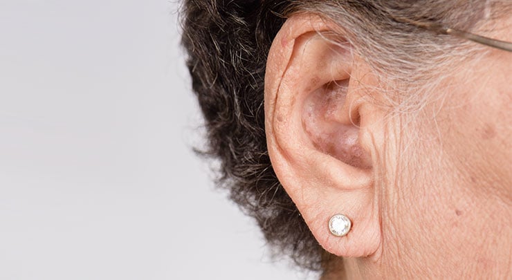 Woman's earlobe that has elongated with age.
