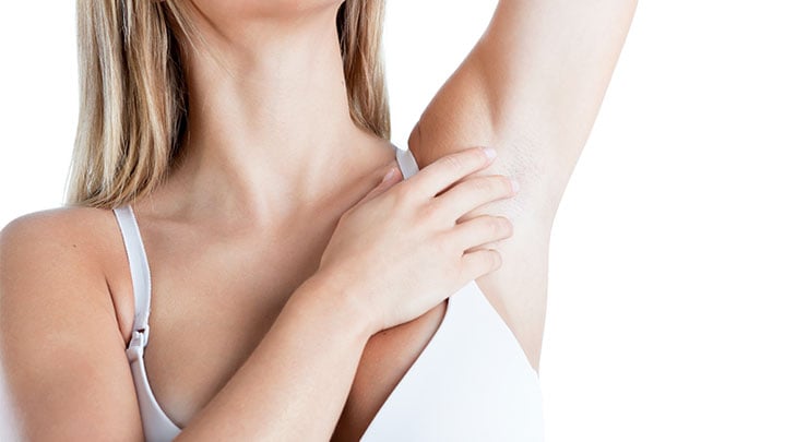 Woman with arm raised to show smooth area after axillary breast removal surgery.