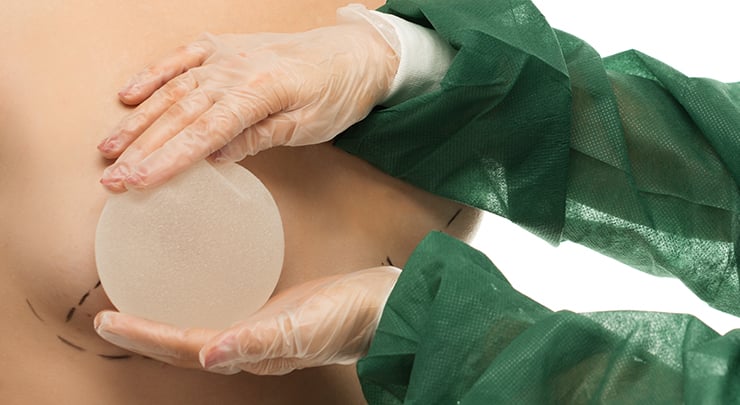 Plastic surgeon holding breast implant against woman's body to determine size.