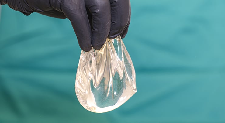 Plastic surgeon holding silicone breast implant during surgery.