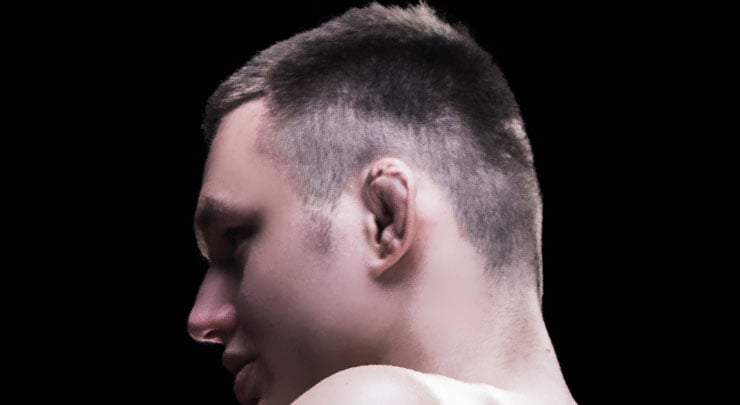 Man with cauliflower ear deformity.