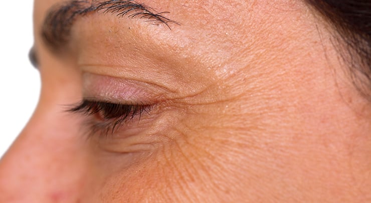 Close up of woman's side of eye, where wrinkles known as crows feet are.