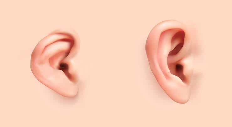 Diagram showing an ear affected by microtia and a normal ear.