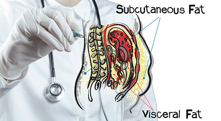 Diagram showing visceral fat and subcutaneous fat on the human body.