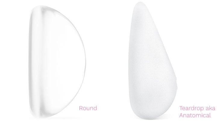 Diagram of round breast implant and teardrop breast implnat