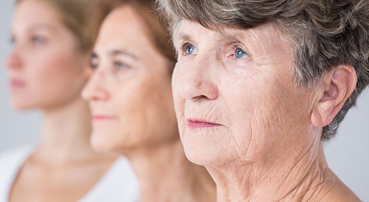 Closeup of older woman's nasolabial folds.